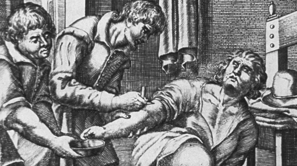 Modern Bloodletting.